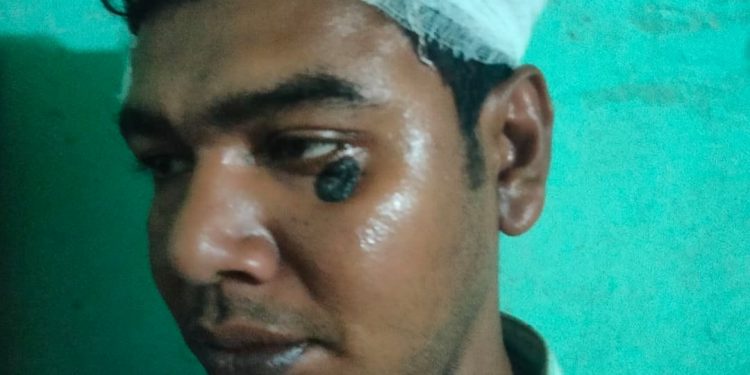 চকরিয়ায় ডিজিটাল সেন্টারের উদ্যোক্তাকে হত্যা চেষ্টা 1 চকরিয়ায় ডিজিটাল সেন্টারের উদ্যোক্তাকে হত্যা চেষ্টা