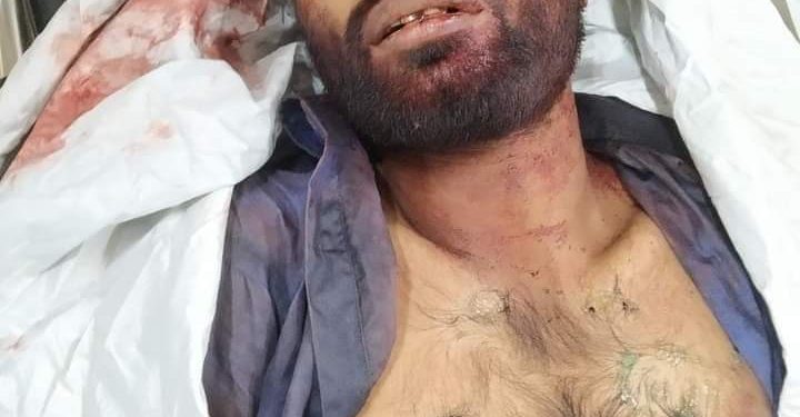 মহেশখালী কালারমারছড়ায় যুবক খুন