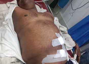 কক্সবাজার জেলা শ্রমিক লীগের সভাপতি ও তার ভাই গুলিবিদ্ধ