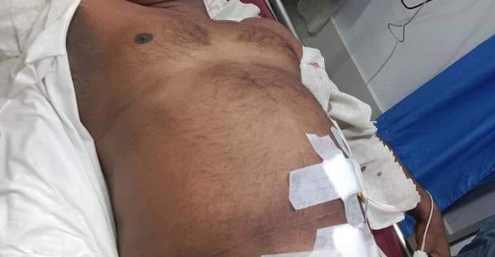 কক্সবাজার জেলা শ্রমিক লীগের সভাপতি ও তার ভাই গুলিবিদ্ধ