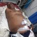 কক্সবাজার জেলা শ্রমিক লীগের সভাপতি ও তার ভাই গুলিবিদ্ধ
