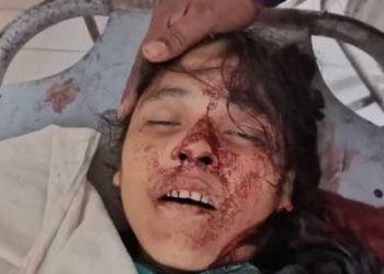 চকরিয়ায় বোনের বাড়িতে বেড়াতে এসে খুন
