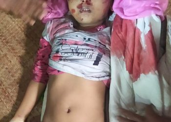 চকরিয়ায় টমটমের ধাক্কায় শিশু নাবিলার মৃত্যু