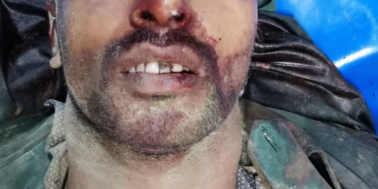 চকরিয়ায় লোকালয়ে দলছুট বন্যহাতি, ভিলেজার নিহত