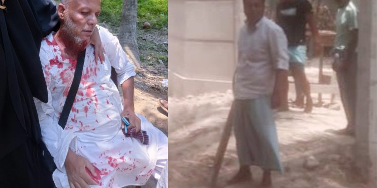 রামুতে জমি নিয়ে বিরোধের জেরে হামলায় আহত ৩, থানায় মামলা দায়ের 1 রামুতে জমি নিয়ে বিরোধের জেরে হামলায় আহত ৩, থানায় মামলা দায়ের