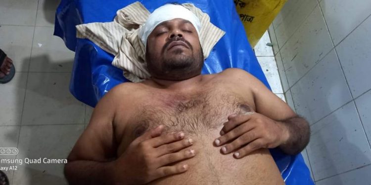 পেকুয়ায় সন্ত্রাসীর গুলিতে বেঁচে যাওয়া আলী আকবরকে এবার কুপিয়েছে 1 পেকুয়ায় সন্ত্রাসীর গুলিতে বেঁচে যাওয়া আলী আকবরকে এবার কুপিয়েছে