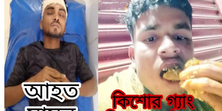 পেকুয়ার কিশোর গ্যাং লিডারের সশস্ত্র হামলায় মাদ্রাসা ছাত্র আহত