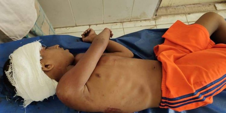 বান্দরবানে ব্যাটারি চালিত টমটমের ধাক্কায় শিশু নিহত 1 বান্দরবানে ব্যাটারি চালিত টমটমের ধাক্কায় শিশু নিহত