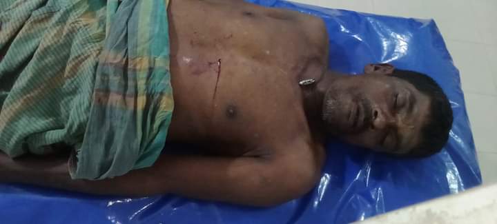 ভারত-পাকিস্তান ক্রিকেটে বাজি, পেকুয়ায় ছুরিকাঘাতে নিহত ১, আহত ৩ 1 ভারত-পাকিস্তান ক্রিকেটে বাজি, পেকুয়ায় ছুরিকাঘাতে নিহত ১, আহত ৩