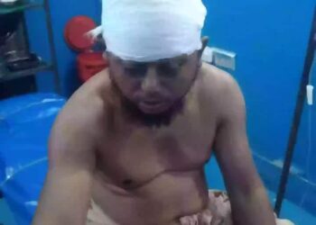 ছেলের দা’য়ের কোপে রক্তাক্ত বাবা