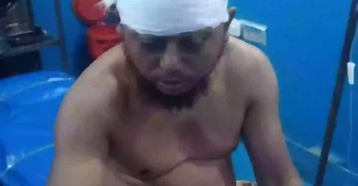 ছেলের দা’য়ের কোপে রক্তাক্ত বাবা