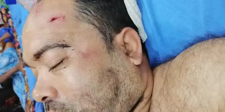 রামুর সাবেক ফুটবলার রুহুল আমিনের উপর হামলার নিন্দা