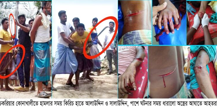 চকরিয়ায় আধিপত্য বিস্তারে  অস্ত্রধারীদের হামলা