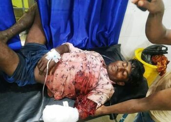 মোমবাইল চুরি সন্দেহে শালার হাত কেটে দিল দুলাভাই
