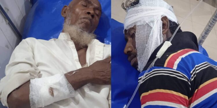 পেকুয়ায় পিতা পুত্রকে কুপিয়ে জখম 1 পেকুয়ায় পিতা পুত্রকে কুপিয়ে জখম