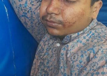 চকরিয়ায় বিধবার বাড়িতে হামলা-ভাংচুর,  মা-ছেলেকে কুপিয়ে জখম
