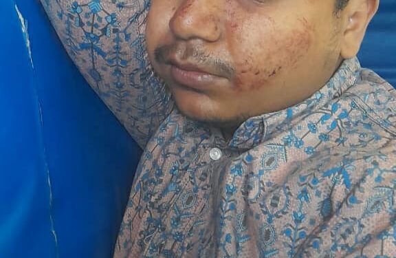 চকরিয়ায় বিধবার বাড়িতে হামলা-ভাংচুর,  মা-ছেলেকে কুপিয়ে জখম
