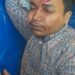 চকরিয়ায় বিধবার বাড়িতে হামলা-ভাংচুর,  মা-ছেলেকে কুপিয়ে জখম