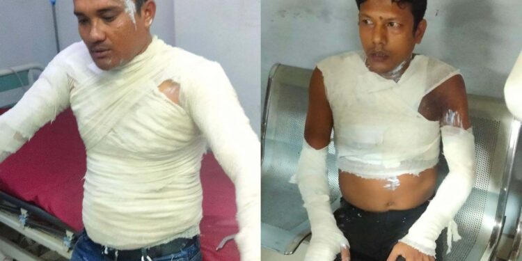 রামুতে দুই ব্যবসায়িকে এসিড নিক্ষেপের ঘটনায় বণিক সমিতির নিন্দা
