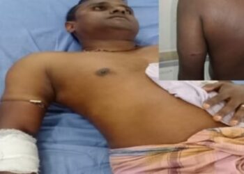 কক্সবাজার পানেরছড়া রেঞ্জের  বনকর্মীর উপর হামলা