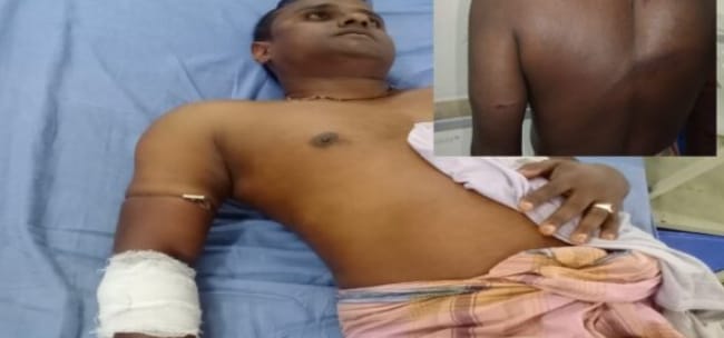 কক্সবাজার পানেরছড়া রেঞ্জের বনকর্মীর উপর হামলা 1 কক্সবাজার পানেরছড়া রেঞ্জের বনকর্মীর উপর হামলা
