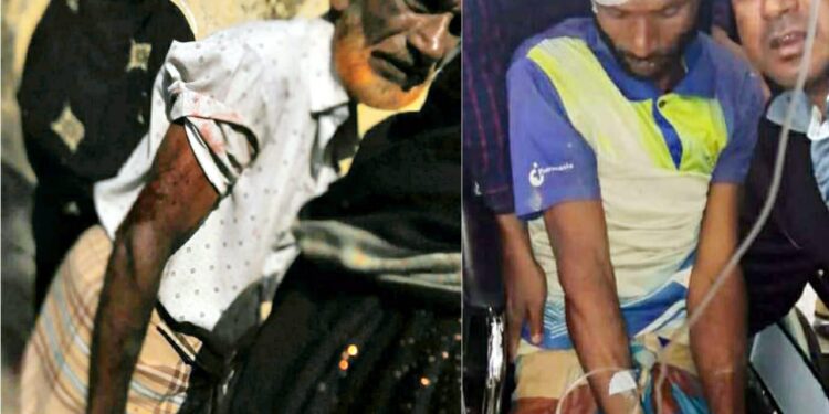 পেকুয়া লবণ মাঠে পানি দেওয়া নিয়ে বাকবিতন্ডার জের মহিলাসহ আহত-৬