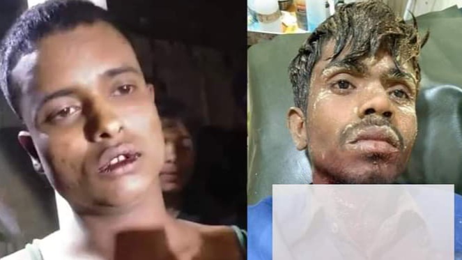 গলায় ছুরি চালিয়ে অটোরিক্সা ছিনতাইয়ের চেষ্টা, আটক-১ 1 গলায় ছুরি চালিয়ে অটোরিক্সা ছিনতাইয়ের চেষ্টা, আটক-১