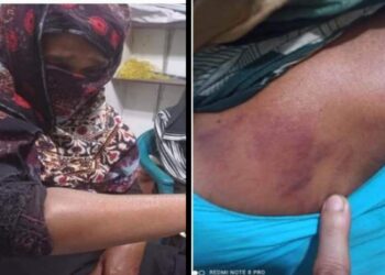 নেশার টাকা না পেয়ে বৃদ্ধা মা’কে পিটিয়ে বাড়ি ছাড়া করল ছেলে
