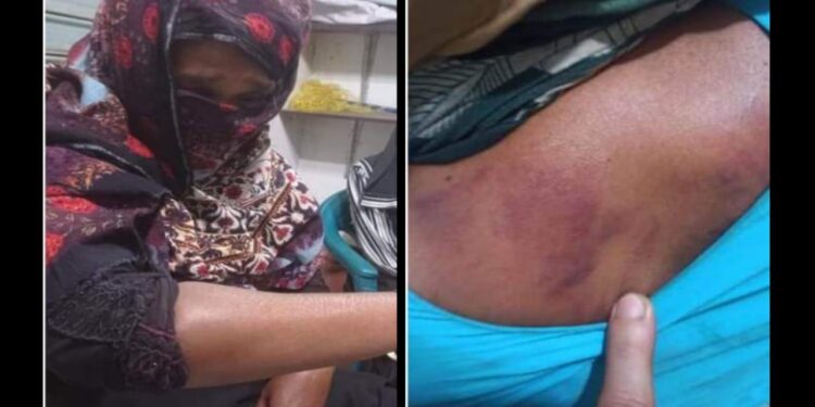 নেশার টাকা না পেয়ে বৃদ্ধা মা’কে পিটিয়ে বাড়ি ছাড়া করল ছেলে