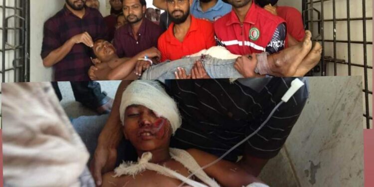 লামা আলীকদমে মাহিন্দ্র দুর্ঘটনায় শিক্ষার্থী, নারী-শিশু সহ আহত ৯ 1 লামা আলীকদমে মাহিন্দ্র দুর্ঘটনায় শিক্ষার্থী, নারী-শিশু সহ আহত ৯