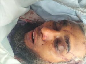 চকরিয়ায় বাসের সাথে মুখোমুখি সংঘর্ষে দুই বাইক আরোহী নিহত 2 IMG 20230315 WA0005