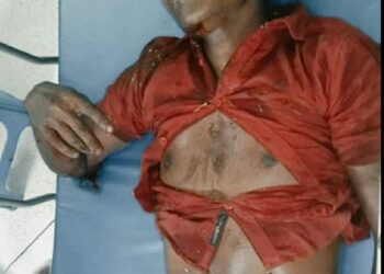 চকরিয়ায় বাসের সঙ্গে ডাম্পার  ট্রাক গাড়ির সংঘর্ষে নিহত-১, আহত-১০
