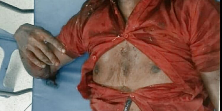 চকরিয়ায় বাসের সঙ্গে ডাম্পার  ট্রাক গাড়ির সংঘর্ষে নিহত-১, আহত-১০