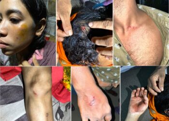 চকরিয়ায় সাংবাদিকদের বাড়িতে সন্ত্রাসী হামলা, আহত ৫, নগদ টাকা ও স্বর্ণালঙ্কার লুট