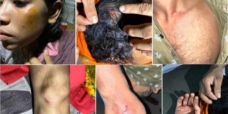 চকরিয়ায় সাংবাদিকদের বাড়িতে সন্ত্রাসী হামলা, আহত ৫, নগদ টাকা ও স্বর্ণালঙ্কার লুট 1 চকরিয়ায় সাংবাদিকদের বাড়িতে সন্ত্রাসী হামলা, আহত ৫, নগদ টাকা ও স্বর্ণালঙ্কার লুট