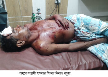 রামুতে সন্ত্রাসী হামলায় গুরুতর আহত ২