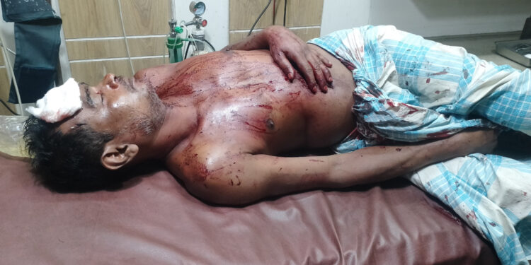 রামুতে সন্ত্রাসী হামলায় গুরুতর আহত ২