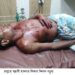 রামুতে সন্ত্রাসী হামলায় গুরুতর আহত ২