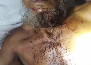 লামায় গরু বেপারি মোহাম্মদ  হোসেন রক্তাক্ত হামলার শিকার