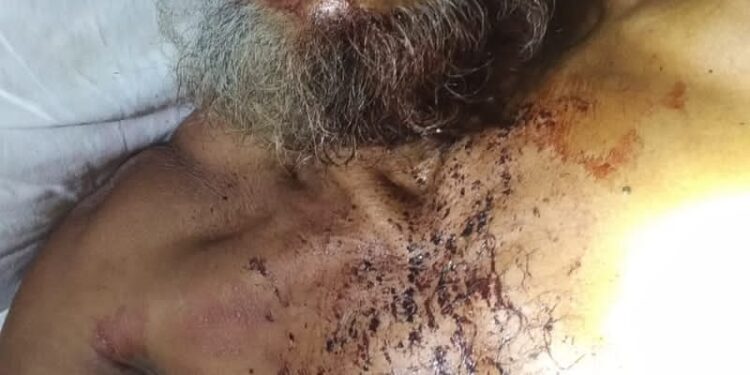 লামায় গরু বেপারি মোহাম্মদ  হোসেন রক্তাক্ত হামলার শিকার