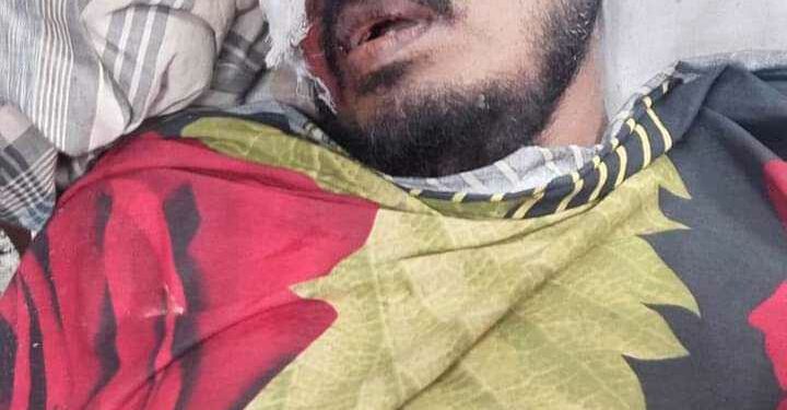 চকরিয়ায় অটোরিকশা উল্টে  এনজিও কর্মকর্তা নিহত