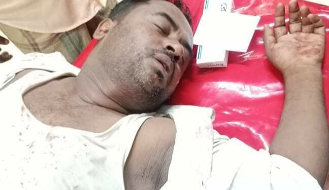 চকরিয়ায় বাড়ি ফেরার পথে আওয়ামী লীগ সভাপতিকে পিটিয়ে জখম 1 চকরিয়ায় বাড়ি ফেরার পথে আওয়ামী লীগ সভাপতিকে পিটিয়ে জখম