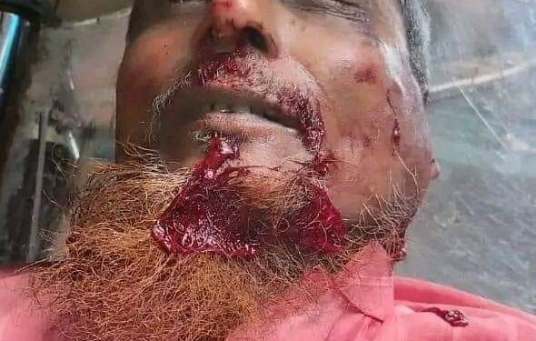 চকরিয়ায় সাঈদীর গায়েবানা জানাজাকে কেন্দ্র করে সহিংসতায় নিহত ১, আহত ১০ 1 চকরিয়ায় সাঈদীর গায়েবানা জানাজাকে কেন্দ্র করে সহিংসতায় নিহত ১, আহত ১০