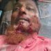 চকরিয়ায় সাঈদীর গায়েবানা জানাজাকে কেন্দ্র করে সহিংসতায় নিহত ১, আহত ১০
