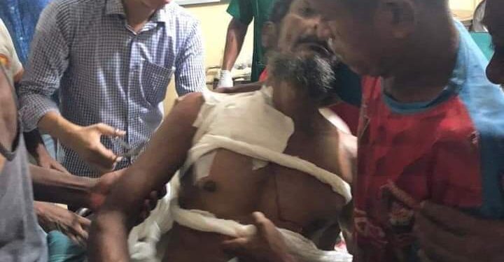 টেকনাফে বিজিবি - স্থানীয়দের মধ্যে সংঘর্ষ: আহত ৬ 1 টেকনাফে বিজিবি – স্থানীয়দের মধ্যে সংঘর্ষ: আহত ৬