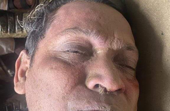 চকরিয়ায় সেনাবাহিনীর সাবেক সদস্যের মরদেহ উদ্ধার