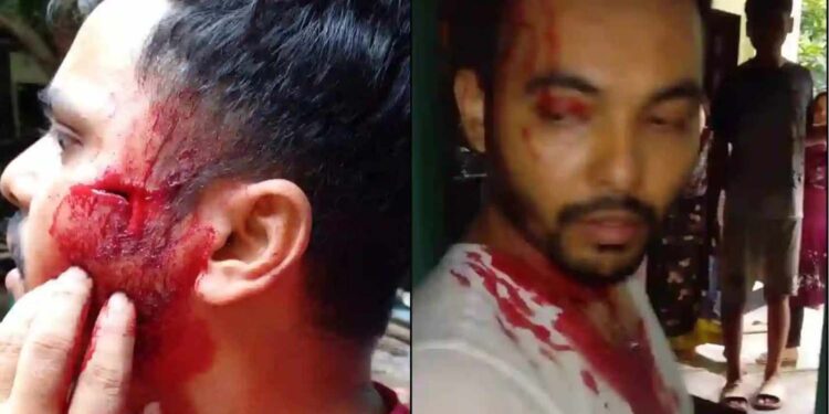রামুতে জমি বিরোধের জেরে হামলা ও ভাংচুর, কুপিয়ে জখম