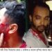 রামুতে জমি বিরোধের জেরে হামলা ও ভাংচুর, কুপিয়ে জখম