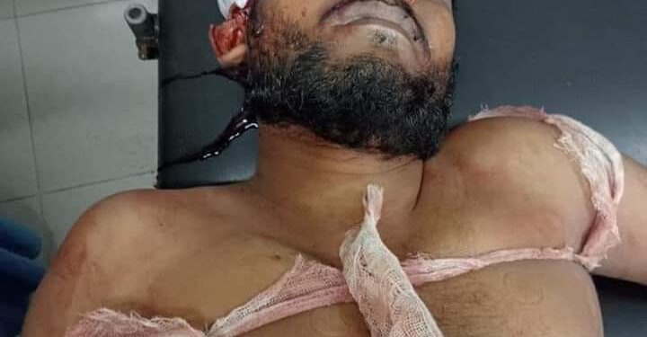 মহেশখালীতে লবণ নিয়ে বিবাদ; নিহত ১, আহত ৩ 1 মহেশখালীতে লবণ নিয়ে বিবাদ; নিহত ১, আহত ৩