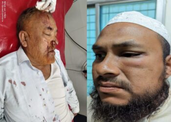 চকরিয়ায় ফিল্মীস্টাইলে সিমেন্ট ডিলারের  দোকানে হামলা,টাকা লুট,আহত ৩